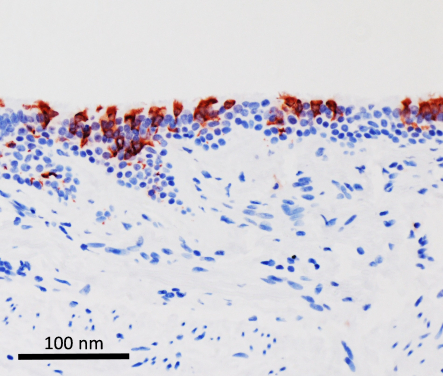 Omicron variant of SARS-CoV-2 (in red) infected human bronchus tissues.

 