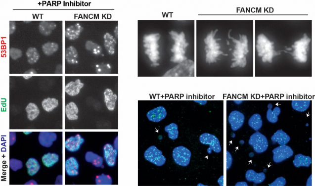 Image 1. Inactivation of a DNA repair gene called FANCM enhances the formation of DNA damage and chromosomal instability induced by a PARP inhibitor, leading to massive cancer cell death.
Image modified from Liu et al, Cell Reports (2024).
 