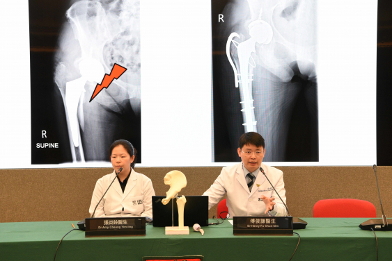 港大醫學院研究證實，接受機械臂輔助全髖關節置換術的患者，之後需要再次進行手術的比率明顯低於採用傳統手術的患者。研究團隊包括傅俊謙醫生（右）及張炎鈴醫生。
 