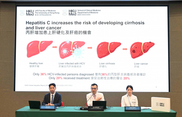 港大醫學院臨床醫學學院內科學系腸胃及肝臟科主任兼講座教授袁孟峰教授（中）指出，針對高風險族群進行有針對性的篩查，是實現世界衞生組織於 2030 年前消除病毒性肝炎目標的關鍵策略。